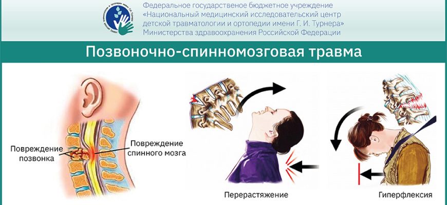 Особенности оказания первой помощи при травмах позвоночника