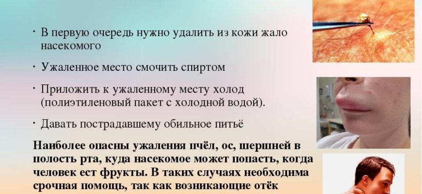 Первая помощь при укусах насекомых и животных во время спортивных мероприятий