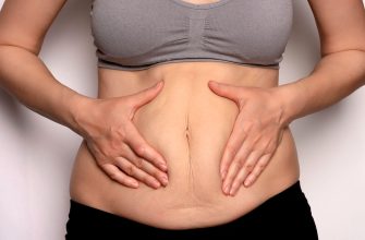 Профилактика диастаза прямых мышц живота с помощью пилатеса