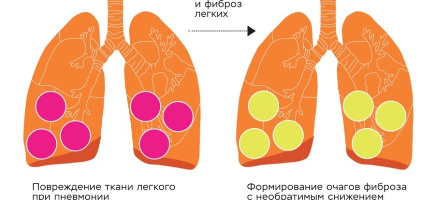 Влияние дыхания на лактатный порог и восстановление после тренировок